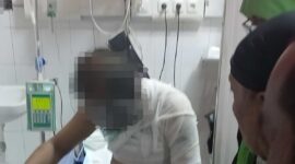 Pengemudi ojek online Stevens Charles Ricky menjalani perawatan di RSUD dr. Mohammad Zyn, karena mengalami luka bakar serius dalam aksi pembegalan. (Ist.)