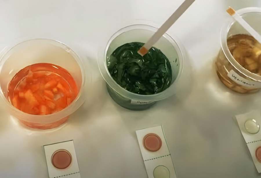 BGN Wajibkan Rapid Test di Semua Dapur MBG, Adopsi Standar Polri